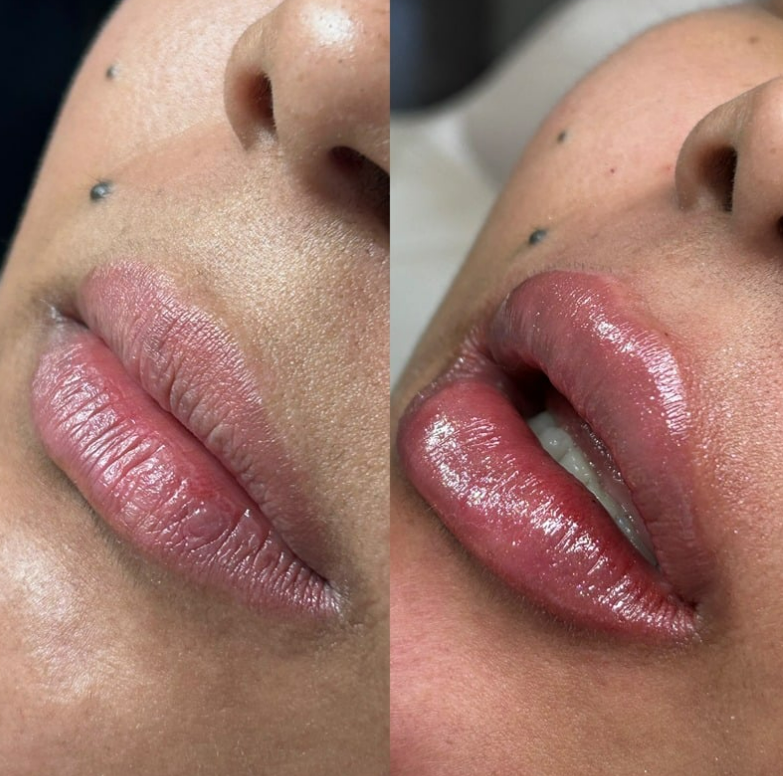 labial02